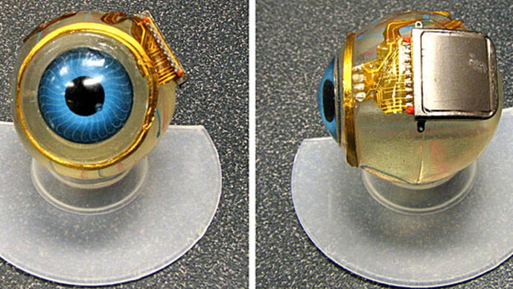 What Is A Bionic Eye