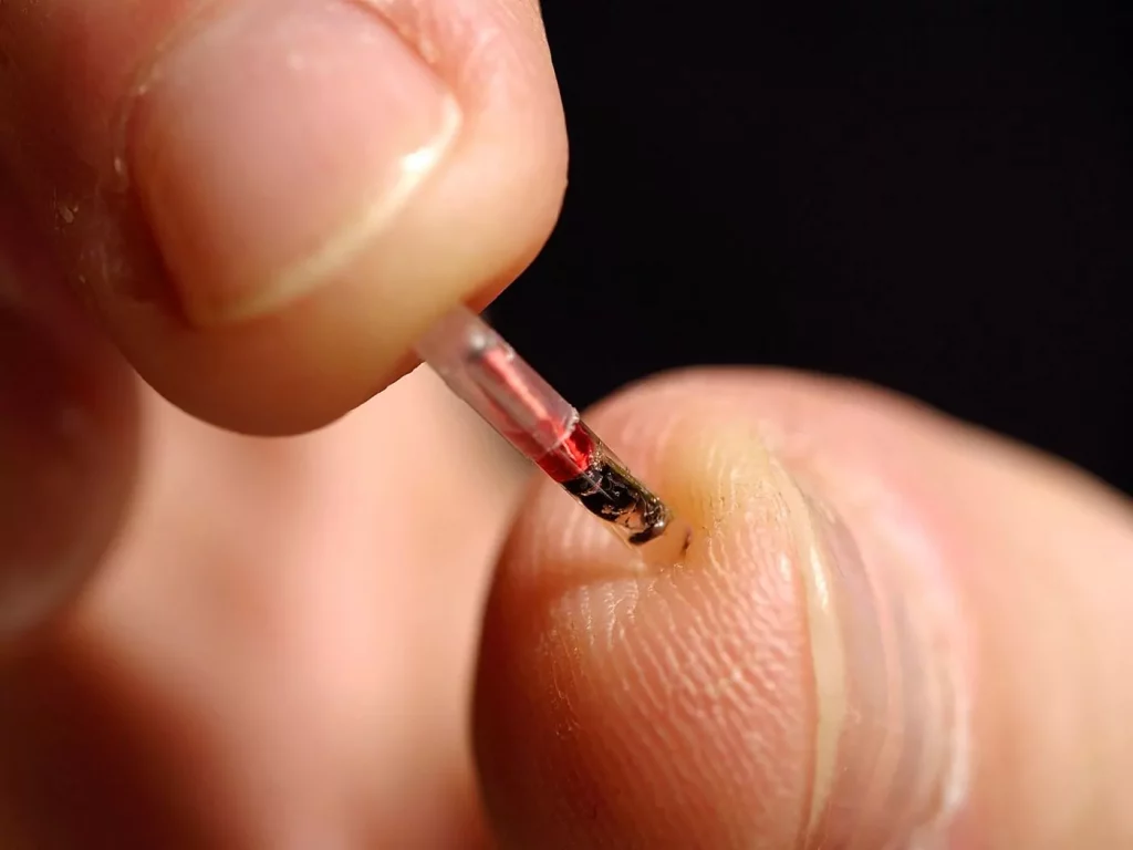 Concerns Regarding Microchip Payment Implant