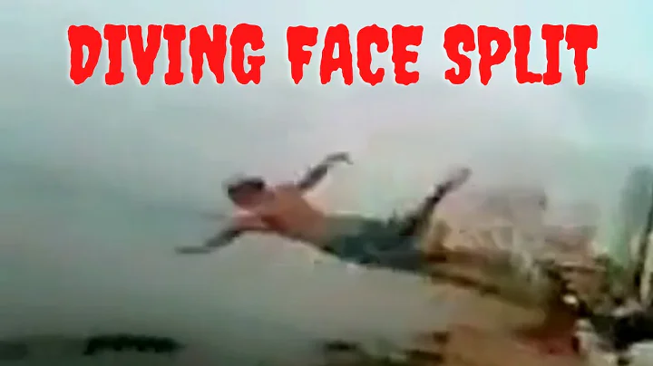 Split Face Diving Accident Twitter